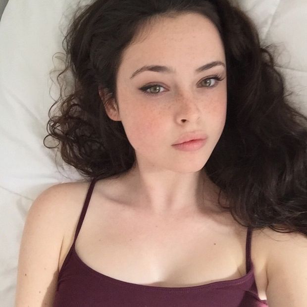 Freckles