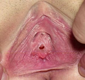 Closeup Virgin Pussy Picture