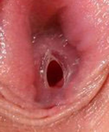 Hymen Closeup Pic