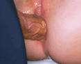 Veiny