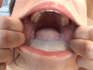 Mouth full of cum