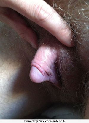 huge clit
