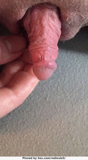huge clit