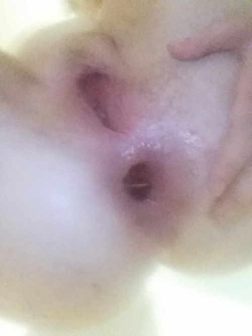 gaped