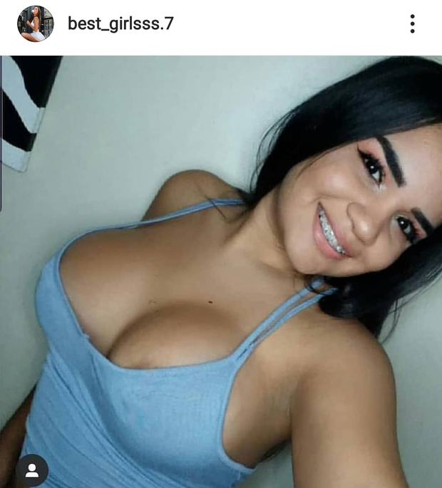 Horny braces