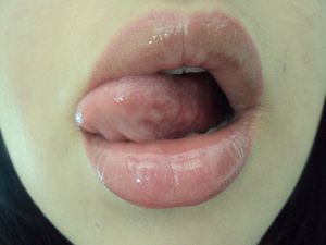 Beautiful Thick Lips