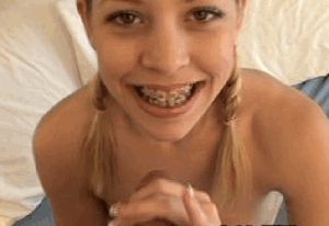 Blowjob with Braces