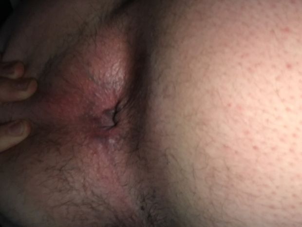 Asshole
