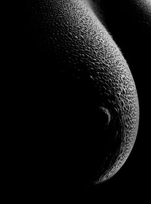 The dark side of the breast