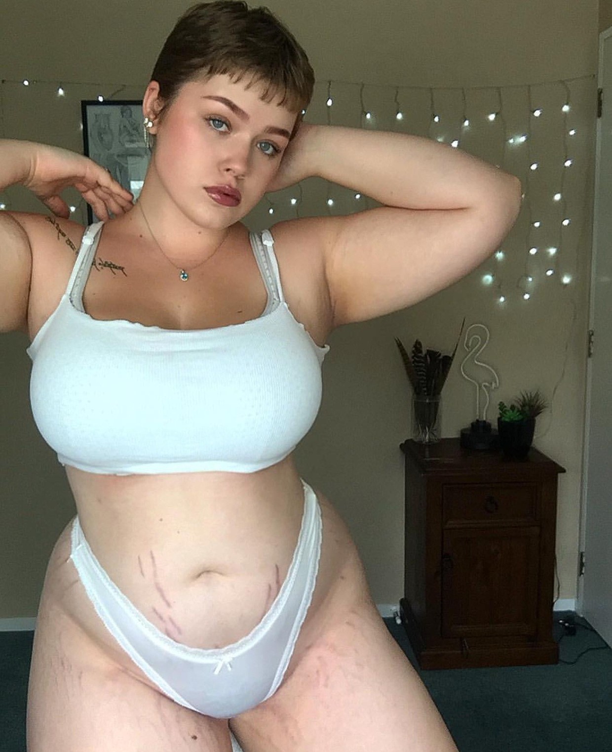 Stretchmarks