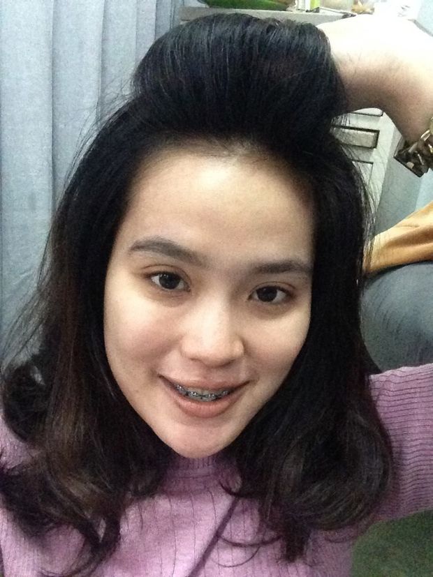 braces teen