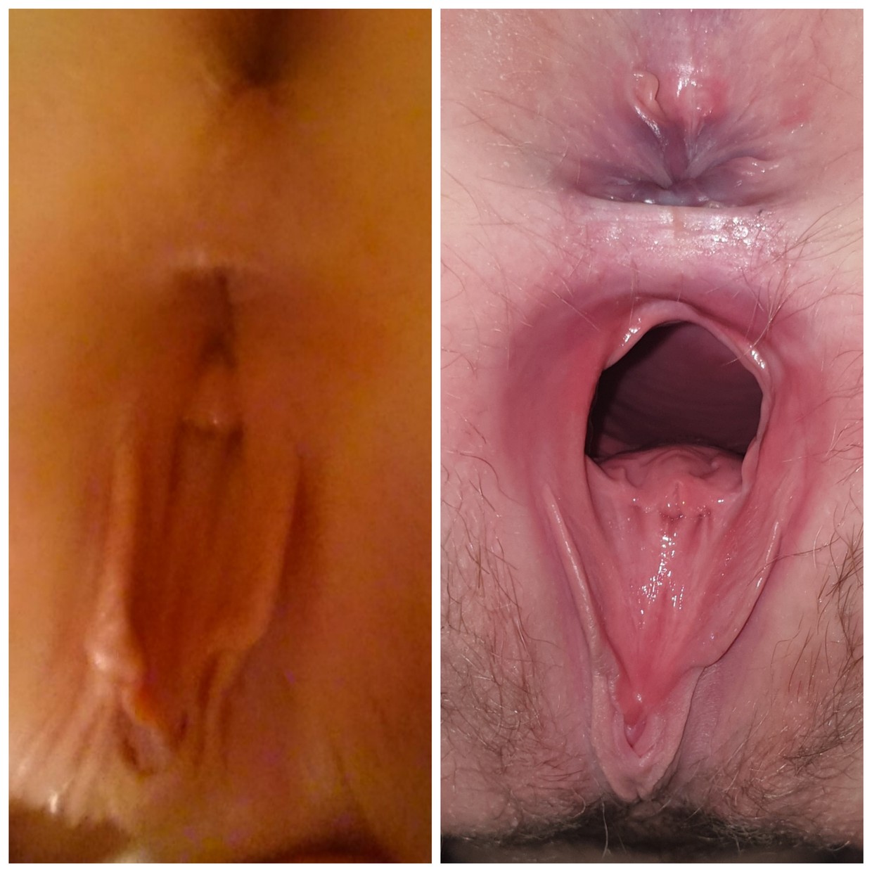 Before & After