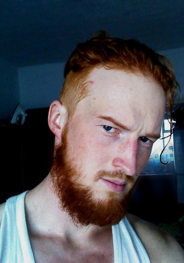 Redhead