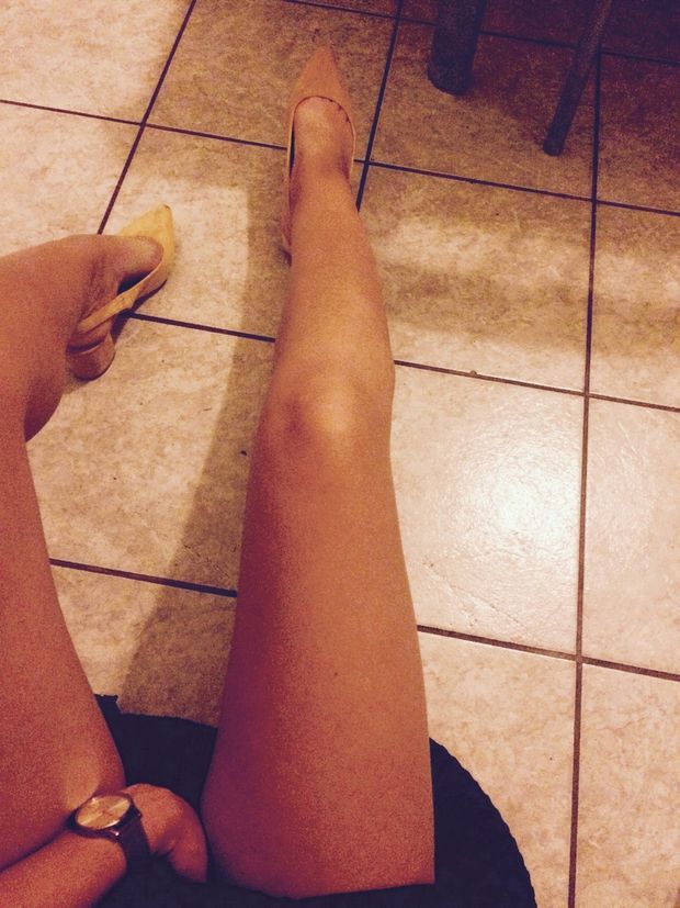Legs