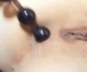 anal action