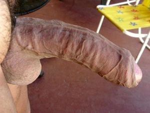 Uncut Cock..