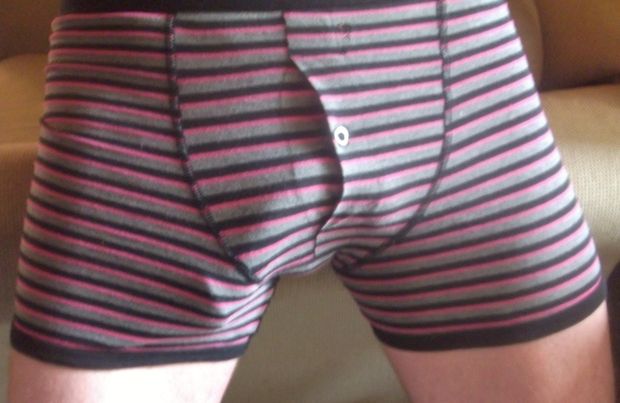 Striped bulge