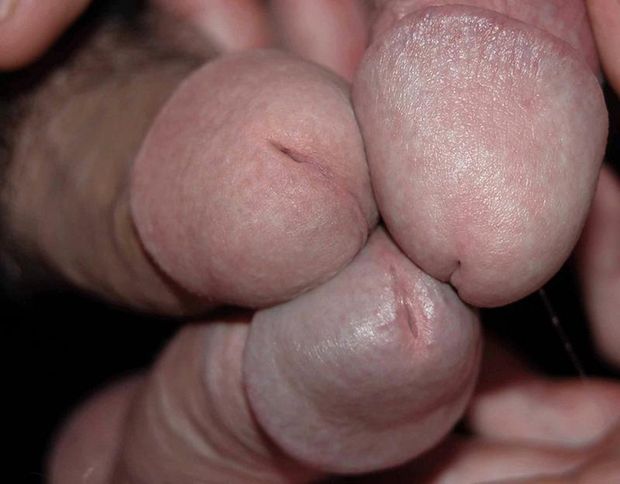 Rubbing cockheads