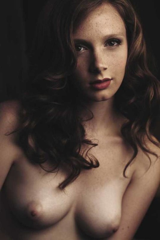 Freckles