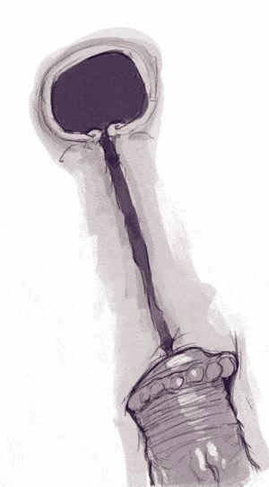 DevilHS - Superslut xray