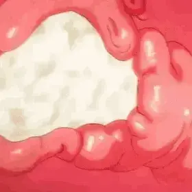 Cum