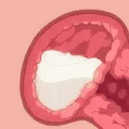 Cum