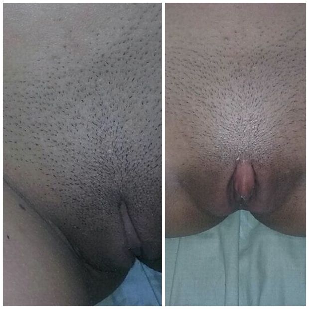 Collage
