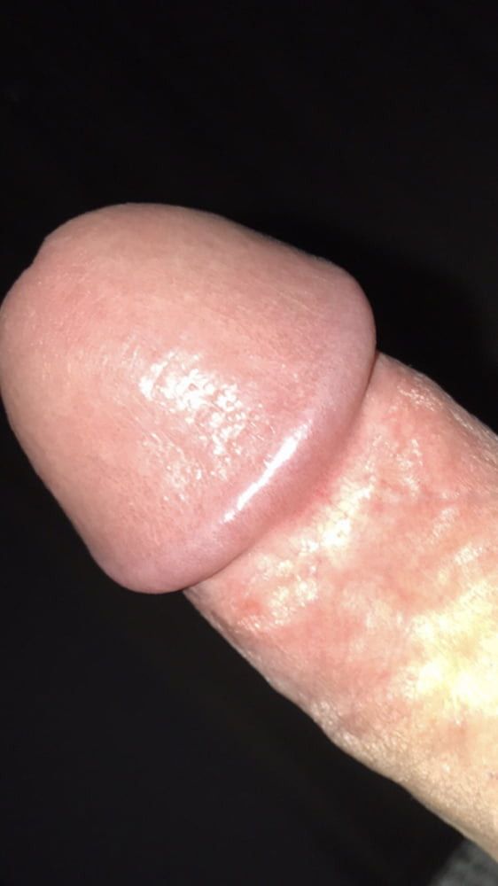The Head Of My Cock