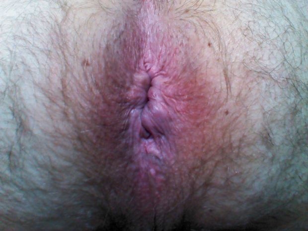 Close up of my hairy asshole