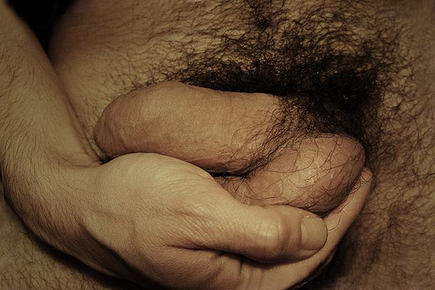 Cupping