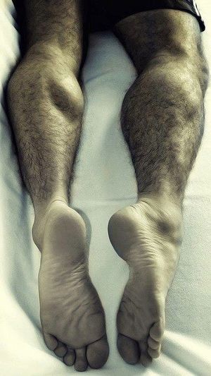 Hairy calves