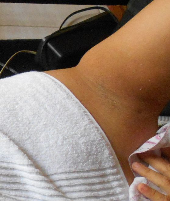 female armpit