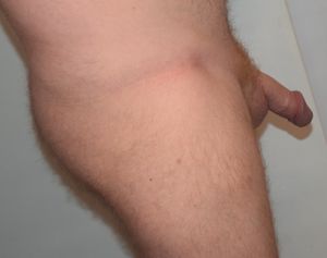 SMC33..Ginger Lovers?