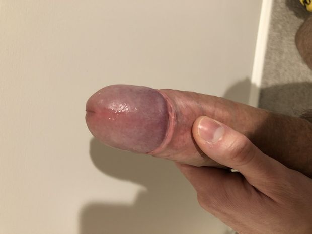 Skin down?