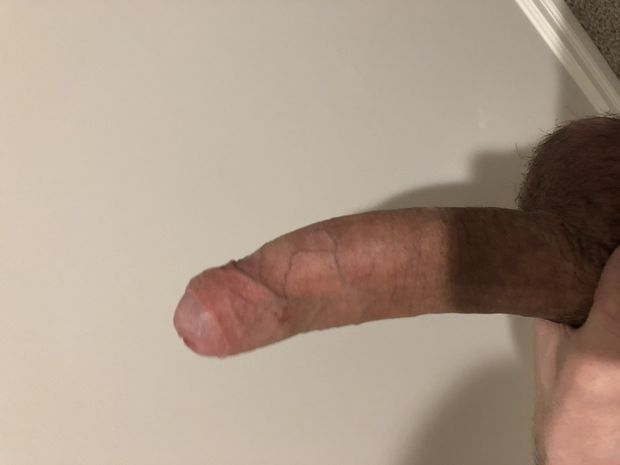 Or skin up?