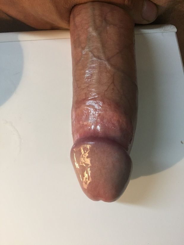 My Dick