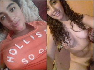 before and after bit tits