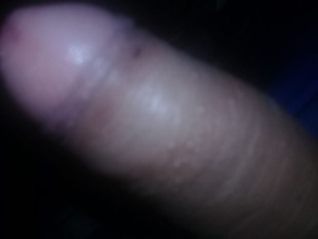 Mi pene