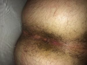 Who’s not std free that wants to pump my asshole full of cum and instantly making me cum I want someone with a dirty nasty cock