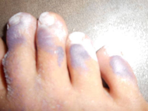 dirty toes