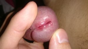 Close up penis peehole
