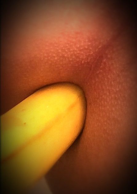 Banana anal
