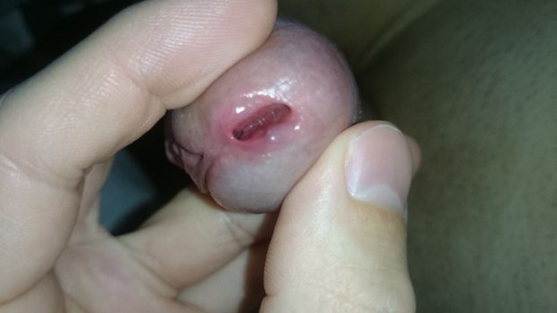 Peehole close-up