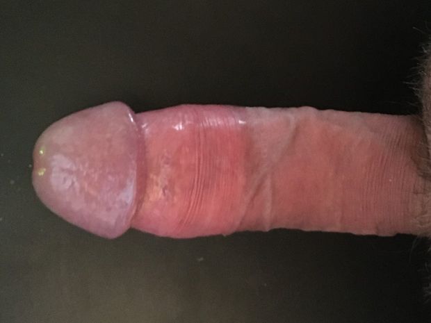 My suckable