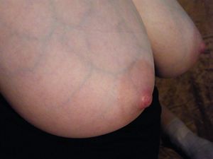 Another one of these huge vein covereed tits