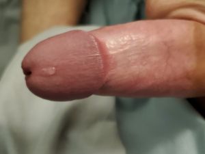 Swollen cock head dripping pretty