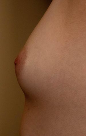 Jack and Jill went up the hill...