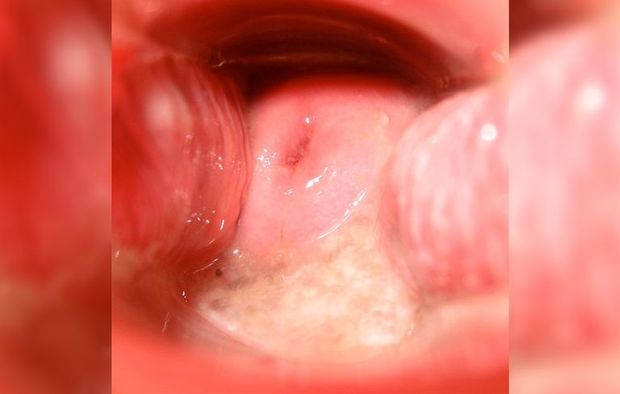 Cervix after orgasm