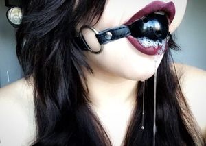mouth gag