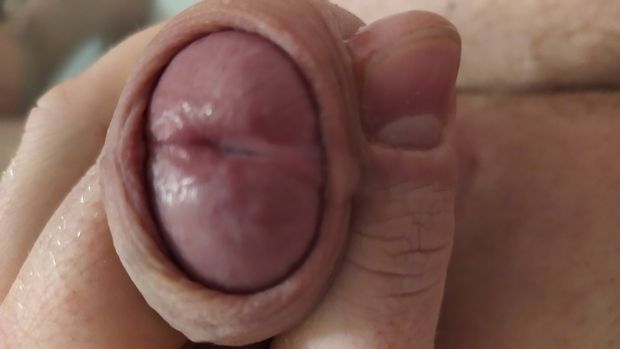 my penis 1